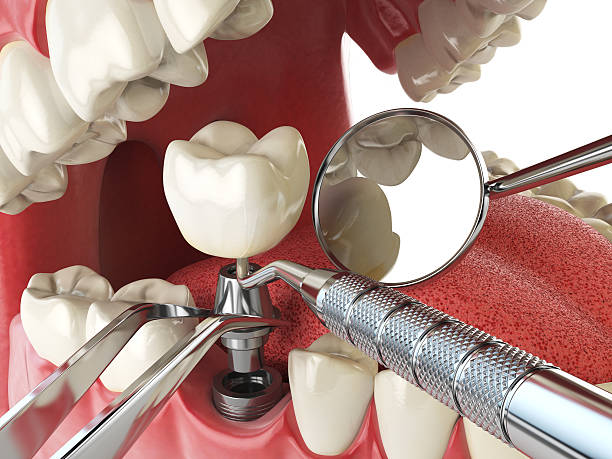 Best Emergency TMJ Treatment in Thoreau, NM